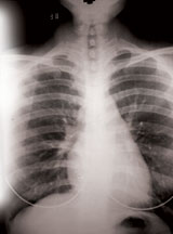 Radiologic Technology