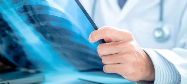 5 Reasons to Become a Radiologic Technologist