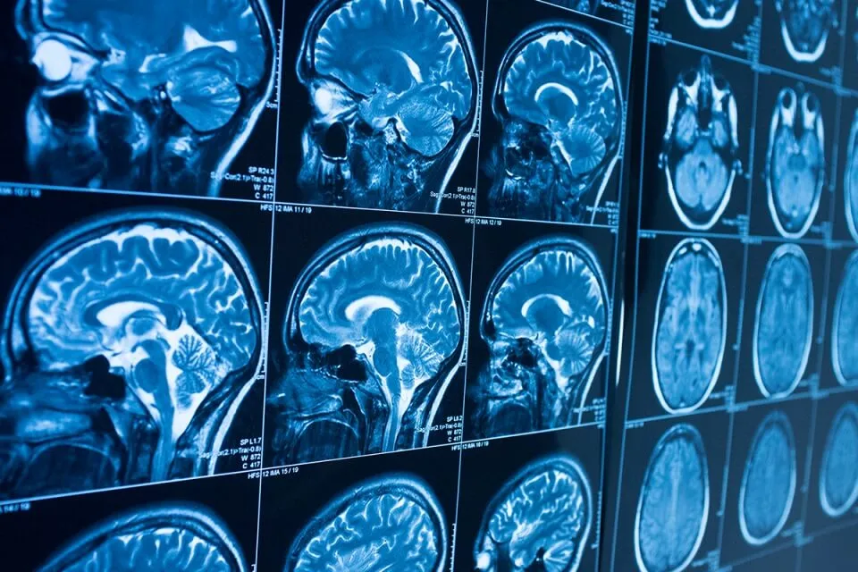 Radiologist Vs. Radiology Tech: What's The Difference?